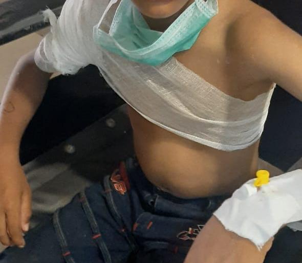  Child injured in bullfight | रानडुकरांच्या हल्ल्यात बालक जखमी