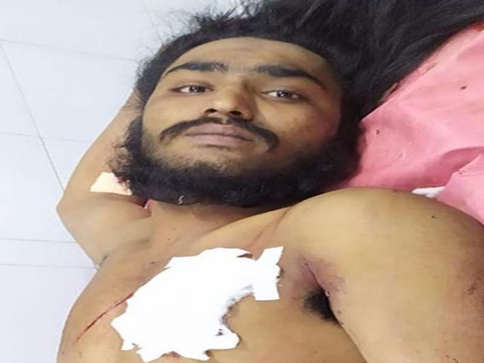 The irrational burglar struck himself with an iron bar | अट्टल घरफोड्याने स्वत:वर केले लोखंडी पट्टीने वार The irrational burglar struck himself with an iron bar | अट्टल घरफोड्याने स्वत:वर केले लोखंडी पट्टीने वार