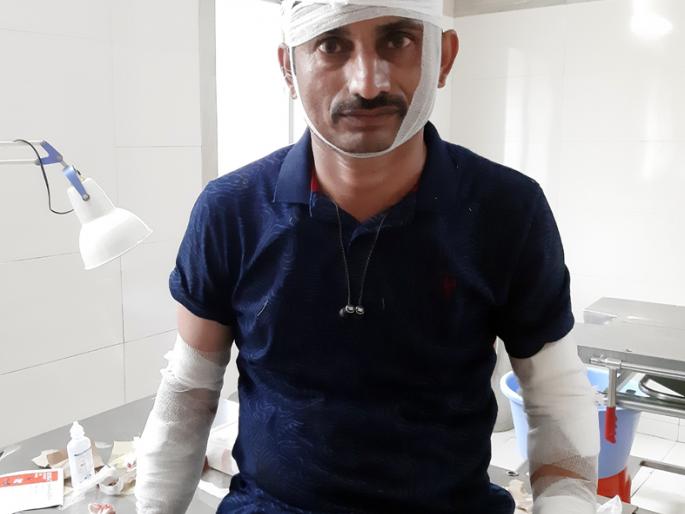 Leopard attack: Four | बिबट्याच्या हल्ल्यात चौघे गंभीर Leopard attack: Four | बिबट्याच्या हल्ल्यात चौघे गंभीर