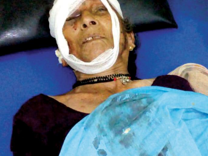 Weekend old market robbery, Amberley type | आठवडा बाजारासाठी आलेल्या वृद्धेला लुटले, आंबेलीतील प्रकार Weekend old market robbery, Amberley type | आठवडा बाजारासाठी आलेल्या वृद्धेला लुटले, आंबेलीतील प्रकार