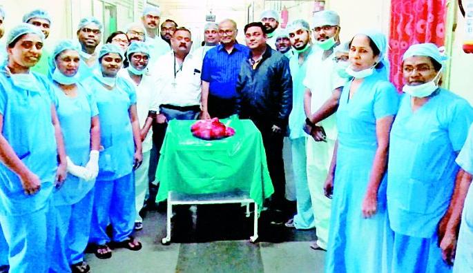 Eight kilos of meat collected from the uterus | गर्भाशयातून काढला आठ किलो मांसाचा गोळा Eight kilos of meat collected from the uterus | गर्भाशयातून काढला आठ किलो मांसाचा गोळा