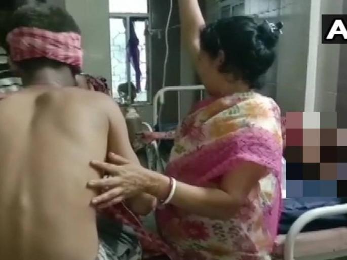 bjp workers injured in a crude bomb blast in Rampur village of South 24 Parganas district | पश्चिम बंगालमध्ये भाजप कार्यकर्त्यांवर बॉम्बहल्ला; ६ जण जखमी