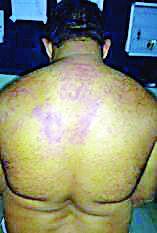 RTI mafia kills journalist | रेती माफियाकडून पत्रकाराला मारहाण RTI mafia kills journalist | रेती माफियाकडून पत्रकाराला मारहाण