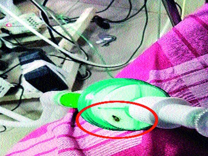 Complaint about the death of a patient in a medical college hospital | वैद्यकीय महाविद्यालय रुग्णालयातील व्हेंटिलेटरमधील झुरळाने मृत्यू झाल्याची तक्रार