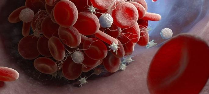 Platelet deficiency puts dengue patients at risk; Huge increase in demand to save lives | प्लेटलेट्सच्या तुटवड्याने डेंग्यूचे रुग्ण धोक्यात; जीव वाचविण्यासाठी मागणीत प्रचंड वाढ Platelet deficiency puts dengue patients at risk; Huge increase in demand to save lives | प्लेटलेट्सच्या तुटवड्याने डेंग्यूचे रुग्ण धोक्यात; जीव वाचविण्यासाठी मागणीत प्रचंड वाढ