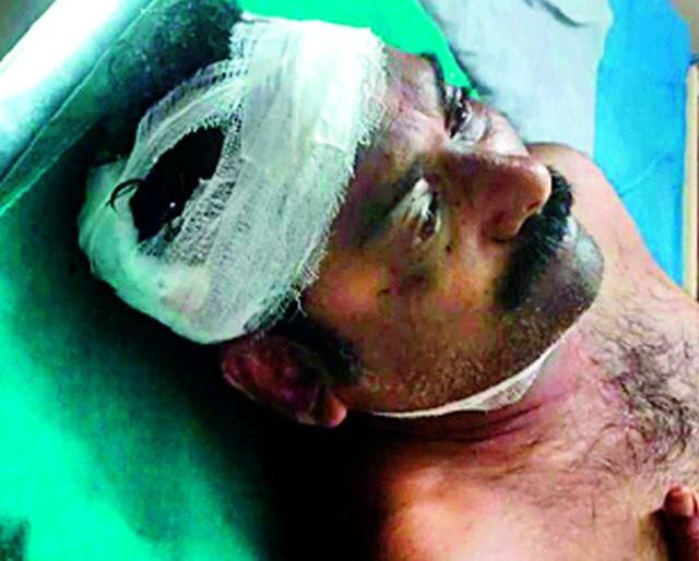 Leaders of the Labor leader | कामगार नेत्यावर प्राणघातक हल्ला