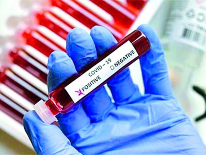 Positivity rate ‘high’; The district is listed in the top five | पॉझिटिव्हीटी रेट ‘हाय’; जिल्ह्याची पहिल्या पाचमध्ये नोंद Positivity rate ‘high’; The district is listed in the top five | पॉझिटिव्हीटी रेट ‘हाय’; जिल्ह्याची पहिल्या पाचमध्ये नोंद