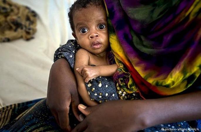 Special diet to provide for the children with severe malnutrition | अतितीव्र कुपोषित बालकांसाठी शासन पुरविणार विशेष आहार Special diet to provide for the children with severe malnutrition | अतितीव्र कुपोषित बालकांसाठी शासन पुरविणार विशेष आहार