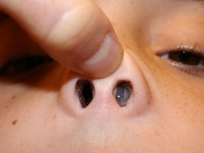 Ever wondered about 'foreign body'? | कधी ऐकलात का ‘फॉरेन बॉडी’बद्दल? Ever wondered about 'foreign body'? | कधी ऐकलात का ‘फॉरेन बॉडी’बद्दल?