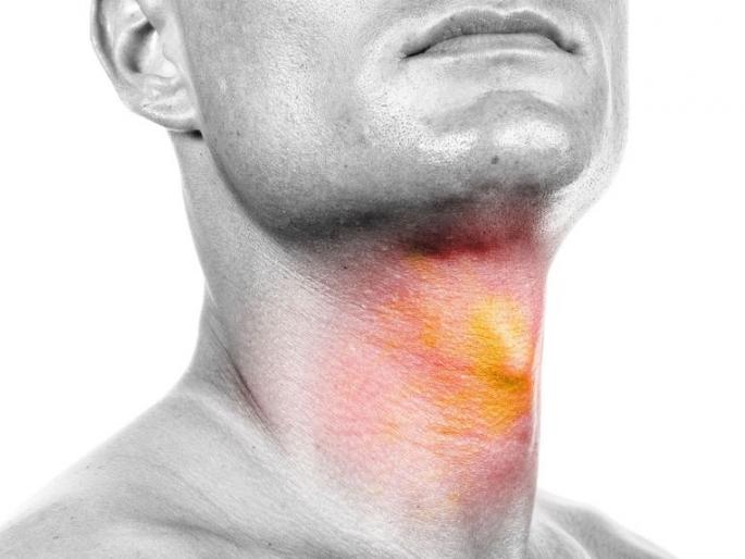 Vidarbha 'Capital' of Head and Neck Cancer | हेड अॅण्ड नेक कॅन्सरची विदर्भ ‘राजधानी’ Vidarbha 'Capital' of Head and Neck Cancer | हेड अॅण्ड नेक कॅन्सरची विदर्भ ‘राजधानी’