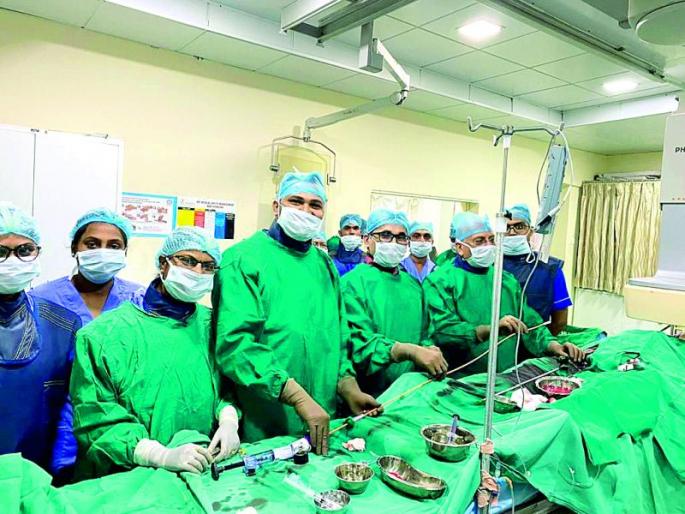 A hole in the heart due to the severity of the heart attack; "Umbrella" closed without surgery | हार्ट अटॅकच्या तीव्रतेमुळे हृदयाला पडले छिद्र; शस्त्रक्रिया न करता ‘छत्री’ने केले बंद A hole in the heart due to the severity of the heart attack; "Umbrella" closed without surgery | हार्ट अटॅकच्या तीव्रतेमुळे हृदयाला पडले छिद्र; शस्त्रक्रिया न करता ‘छत्री’ने केले बंद