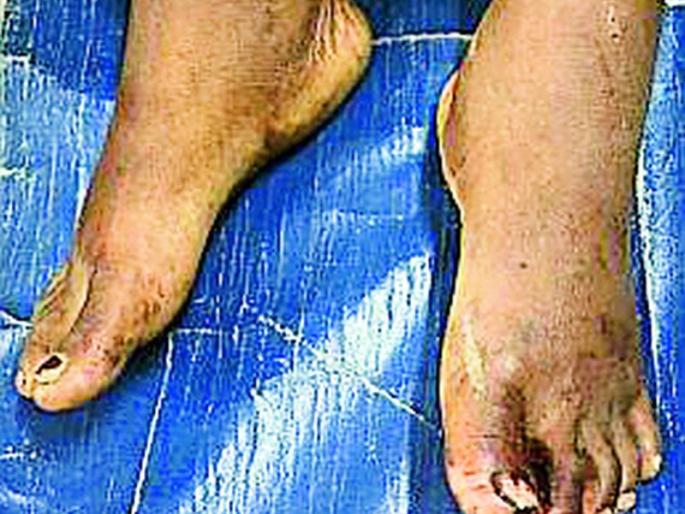 Shalikaram arrest who brutally assaulted his wife | पत्नीला अमानुष मारहाण करणारा शालिकराम गजाआड Shalikaram arrest who brutally assaulted his wife | पत्नीला अमानुष मारहाण करणारा शालिकराम गजाआड