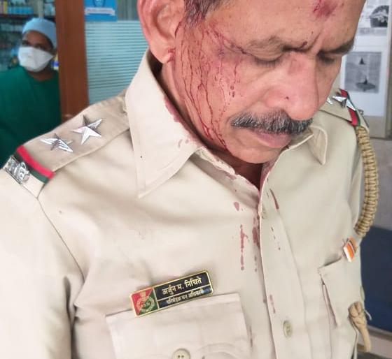 Three injured, including two forest rangers at Kalwa, Thane | कळव्यात अतिक्रमण हटविणाऱ्या वनकर्मचाऱ्यांवर दगडफेक: दोन वनपालांसह तिघे जखमी Three injured, including two forest rangers at Kalwa, Thane | कळव्यात अतिक्रमण हटविणाऱ्या वनकर्मचाऱ्यांवर दगडफेक: दोन वनपालांसह तिघे जखमी