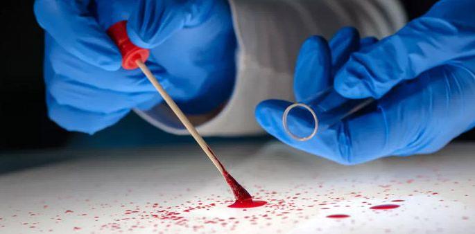 One lakh forensic experts in the country | देशात एक लाख फोरेन्सिक तज्ज्ञांचा तुडवडा One lakh forensic experts in the country | देशात एक लाख फोरेन्सिक तज्ज्ञांचा तुडवडा
