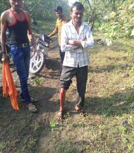 Farmers injured in attack by three bears | तीन अस्वलांनी केलेल्या हल्ल्यात शेतकरी जखमी Farmers injured in attack by three bears | तीन अस्वलांनी केलेल्या हल्ल्यात शेतकरी जखमी