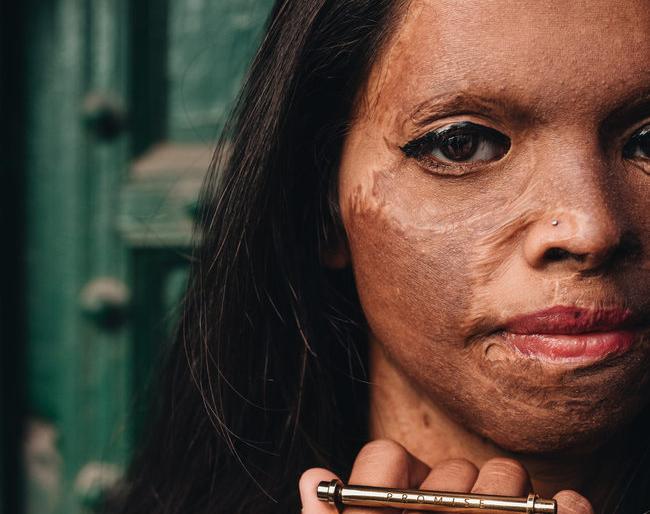 Acid attack victim Lakshmi became the jewelery brand ambassador now | अ‍ॅसिडहल्ला पीडित लक्ष्मी बनली आता दागिन्यांची ब्रॅन्ड अ‍ॅम्बेसेडर