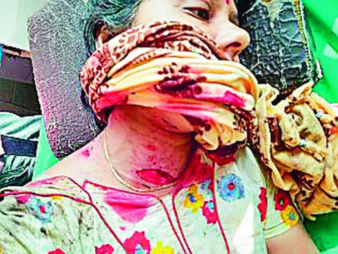 Woman seriously injured in leopard attack | बिबट्याच्या हल्ल्यात महिला गंभीर जखमी Woman seriously injured in leopard attack | बिबट्याच्या हल्ल्यात महिला गंभीर जखमी