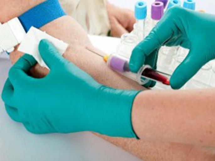 Five blood samples in the laboratory | पाच जणांचे रक्त नमुने प्रयोगशाळेत Five blood samples in the laboratory | पाच जणांचे रक्त नमुने प्रयोगशाळेत