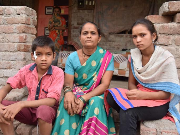 Two children injured in Dibeta attack | बिबट्याच्या हल्ल्यात भाऊ-बहिण जखमी  Two children injured in Dibeta attack | बिबट्याच्या हल्ल्यात भाऊ-बहिण जखमी