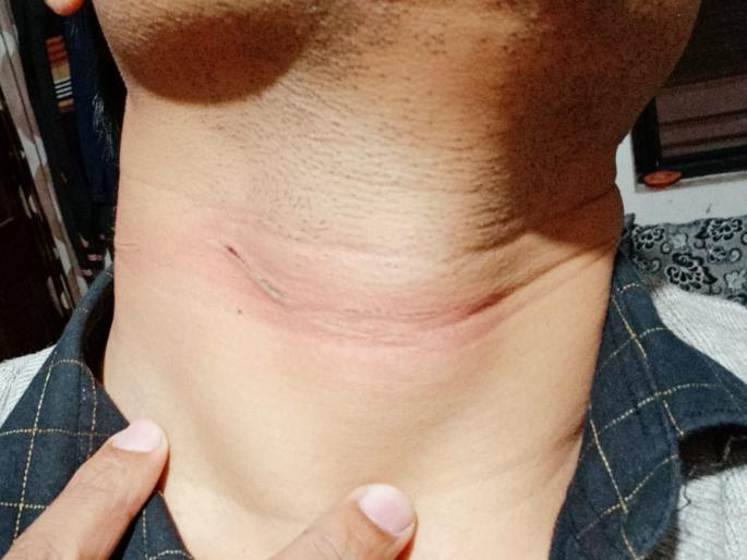 Widespread sale of nylon cats in Sinnar city | सिन्नर शहरात नायलॉन मांजाची सर्रास विक्री Widespread sale of nylon cats in Sinnar city | सिन्नर शहरात नायलॉन मांजाची सर्रास विक्री