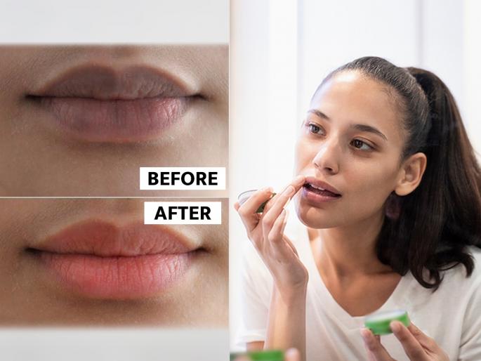 Reasons and Remedies for Dark Lips : Are your lips too dark? Experts say 8 important reasons and remedies for... | ओठ खूप काळे पडलेत? तज्ज्ञ सांगतात ८ महत्त्वाची कारणं आणि उपाय...
