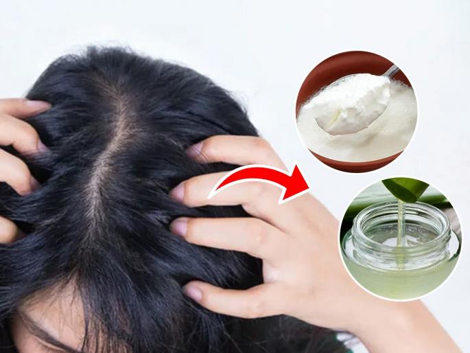 Beauty tips for dry scalp home remedies 3 best home remedies for dry scalp how to get rid of dry scalp naturally home remedies to remove scalp dryness natural remedies for dry itchy scalp | स्काल्पची त्वचा वारंवार कोरडी पडतेय? ३ पदार्थांनी करा मिनिटभर स्काल्पचा मसाज - कोरडेपणा होईल दूर...