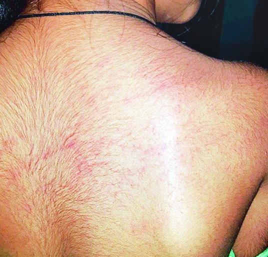 Teacher beats student for not going to shop | अमानुष; दुकानात जाण्यास नकार दिल्याने शिक्षिकेची विद्यार्थिनीस बेदम मारहाण Teacher beats student for not going to shop | अमानुष; दुकानात जाण्यास नकार दिल्याने शिक्षिकेची विद्यार्थिनीस बेदम मारहाण