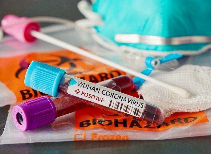 Two more coronas in Nagpur; Total no 16 | Corona Virus in Nagpur; नागपुरात अजून दोघे कोरोनाबाधित; एकूण संख्या १६; विदर्भ २१ Two more coronas in Nagpur; Total no 16 | Corona Virus in Nagpur; नागपुरात अजून दोघे कोरोनाबाधित; एकूण संख्या १६; विदर्भ २१