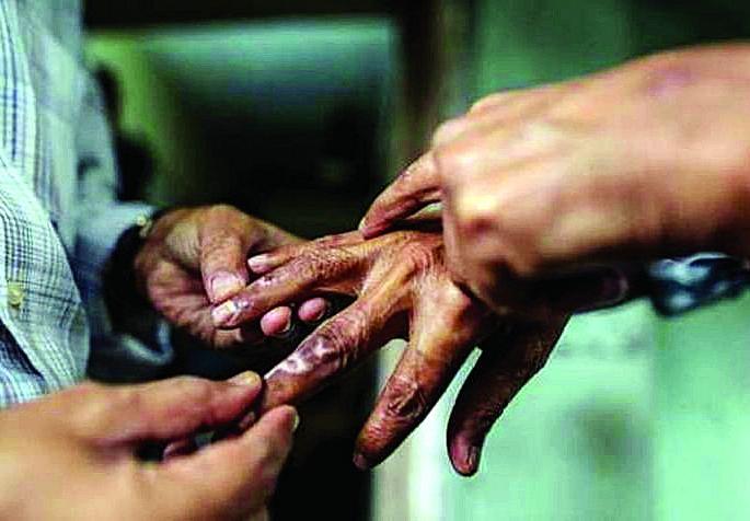 Detection of leprosy patients will go from house to house in Nagpur | नागपुरात घरोघरी जाऊन घेणार कुष्ठरुग्णांचा शोध Detection of leprosy patients will go from house to house in Nagpur | नागपुरात घरोघरी जाऊन घेणार कुष्ठरुग्णांचा शोध