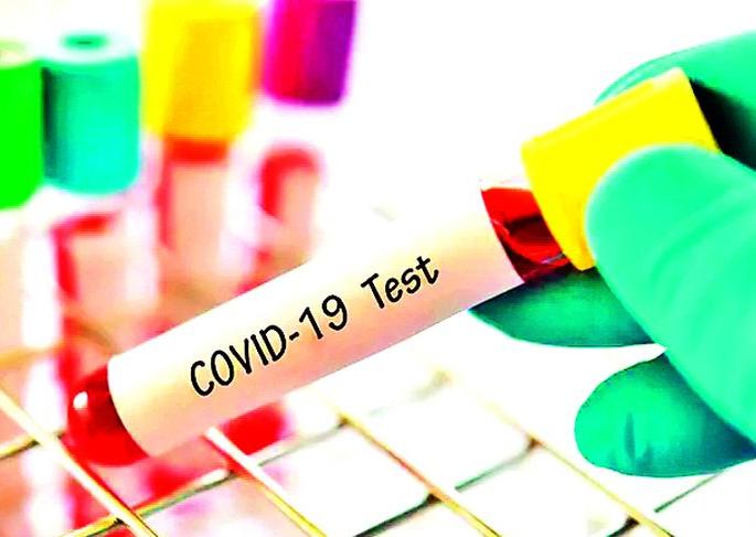 Tests of over five lakh people; 65 thousand Bhandaravasi positive | तब्बल पाच लाख लोकांची टेस्ट; 65 हजार भंडारावासी पाॅझिटिव्ह