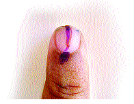 Alliance in Kolhapur due to the brotherhood of the inclinations - Alliance in front is inadmissible | इच्छुकांच्या भाऊगर्दीमुळे कोल्हापुरात युती - आघाडीत बंडखोरी अटळ Alliance in Kolhapur due to the brotherhood of the inclinations - Alliance in front is inadmissible | इच्छुकांच्या भाऊगर्दीमुळे कोल्हापुरात युती - आघाडीत बंडखोरी अटळ