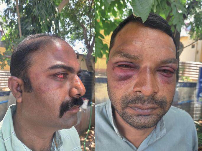 Fatal attack on two policemen over eating in a hotel, incident in Padegaon | हॉटेलमध्ये जेवण्यावरून दोन पोलिसांवर जीवघेणा हल्ला, पडेगावातील घटना Fatal attack on two policemen over eating in a hotel, incident in Padegaon | हॉटेलमध्ये जेवण्यावरून दोन पोलिसांवर जीवघेणा हल्ला, पडेगावातील घटना
