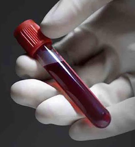 6 months free medicines available at Parbhani | परभणीत ६ महिन्यांचा औषधीसाठा उपलब्ध 6 months free medicines available at Parbhani | परभणीत ६ महिन्यांचा औषधीसाठा उपलब्ध