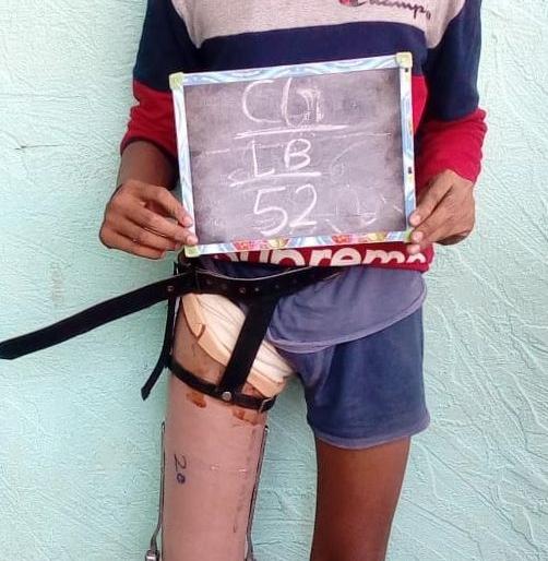 Artificial organ transplantation to 255 Divas in Chalisgaon | चाळीसगावला २५५ दिव्यांगांंना कृत्रिम अवयव रोपण