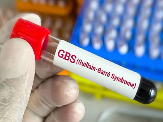 Eight and a half year old boy diagnosed with GBS, treatment underway at government hospital in Akola | साडेआठवर्षीय बालकाला जीबीएसचा आजार, अकोला येथील शासकीय रुग्णालयात उपचार सुरू Eight and a half year old boy diagnosed with GBS, treatment underway at government hospital in Akola | साडेआठवर्षीय बालकाला जीबीएसचा आजार, अकोला येथील शासकीय रुग्णालयात उपचार सुरू