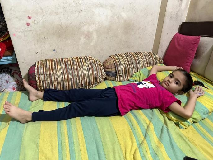 A five-year-old girl's cut off by stray dogs in Nagpur | नागपुरात मोकाट कुत्र्यांचा हैदोस, पाच वर्षीय चिमुकलीचे लचके तोडले A five-year-old girl's cut off by stray dogs in Nagpur | नागपुरात मोकाट कुत्र्यांचा हैदोस, पाच वर्षीय चिमुकलीचे लचके तोडले