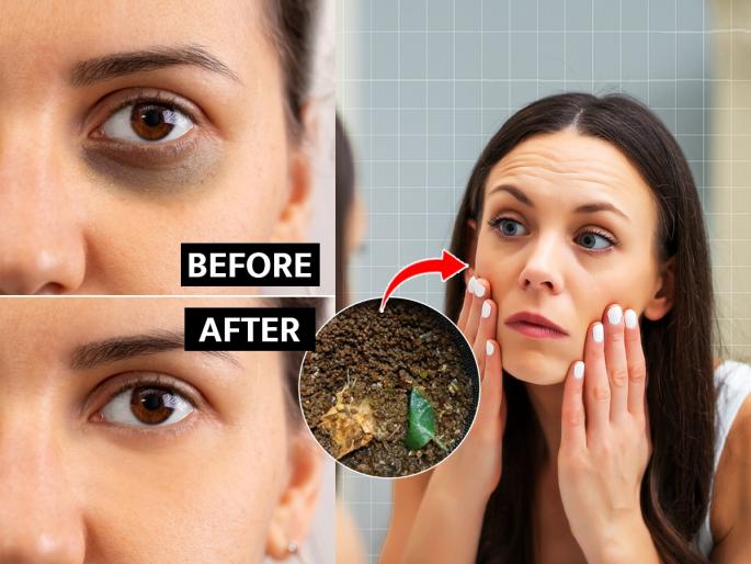 Home Remedy For Dark Circles : After straining the tea, do you throw it away? Use this to get rid of dark circles, amazing benefits - you will look beautiful | चहा गाळल्यावर चोथा फेकून देता? डार्क सर्कल घालवण्यासाठी असा करा वापर, भन्नाट फायदे- दिसाल सुंदर