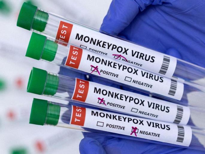 What does monkeypox have to do with sex? | मंकीपॉक्सचा लैंगिक संबंधाशी काय ‘संबंध’? What does monkeypox have to do with sex? | मंकीपॉक्सचा लैंगिक संबंधाशी काय ‘संबंध’?