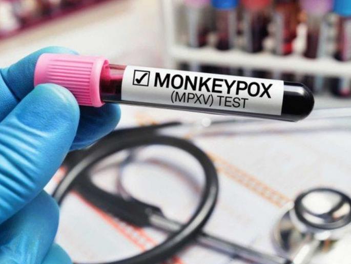 MonkeyPox in India: Suspected monkeypox patient dies in Kerala; Came from UAE | MonkeyPox in India: मंकीपॉक्सच्या संशयित रुग्णाचा मृत्यू; केरळसह दिल्लीपर्यंत आरोग्य यंत्रणा हादरल्या MonkeyPox in India: Suspected monkeypox patient dies in Kerala; Came from UAE | MonkeyPox in India: मंकीपॉक्सच्या संशयित रुग्णाचा मृत्यू; केरळसह दिल्लीपर्यंत आरोग्य यंत्रणा हादरल्या