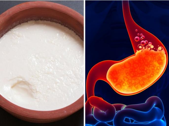 World food safety day 2023 : Wrong food combination to avoid according to Ayurveda | दूध, बटाटे-दह्यासोबत हे पदार्थ खाल्ल्याने होतात अनेक आजार, वेळीच व्हा सावध!