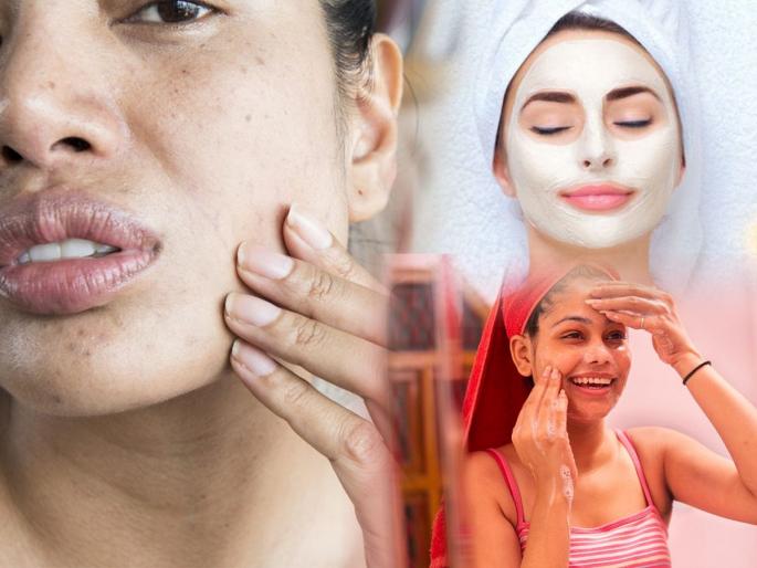 4 homemade face pack are easy solutions for make a dry skin soft | काॅफी पावडर-खोबरेल तेल, ऑलिव्ह ऑइल आहे घरात? 4 लेप असरदार, त्वचा मऊ तजेलदार