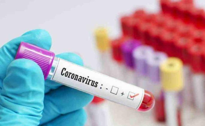 Another 408 corona positive patients were found | आणखी ४०८ कोरोना पॉझिटिव्ह रुग्ण आढळले