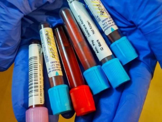 Buldana: 55 more positive, 95 patients overcome corona | बुलडाणा : आणखी ५५ पॉझिटीव्ह, ९५ रुग्णांची कोरोनावर मात Buldana: 55 more positive, 95 patients overcome corona | बुलडाणा : आणखी ५५ पॉझिटीव्ह, ९५ रुग्णांची कोरोनावर मात