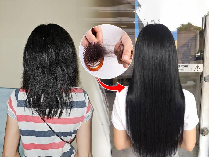 Hair Growth Remedies hair care Tips : Hair doesn't grow after doing anything? 2 easy solutions, hair will grow profusely... | केस काही केल्या वाढतच नाहीत? २ सोपे उपाय, केस वाढतील लांबसडक, होतील मजबूत