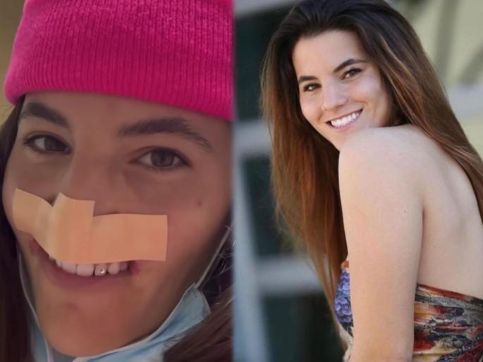 Model mouth savaged dog attack surgery smile | कुत्र्याने तोडला होता मॉडलच्या ओठाचा लचका, सर्जरीसाठी ३ कोटी रूपये केला खर्च Model mouth savaged dog attack surgery smile | कुत्र्याने तोडला होता मॉडलच्या ओठाचा लचका, सर्जरीसाठी ३ कोटी रूपये केला खर्च