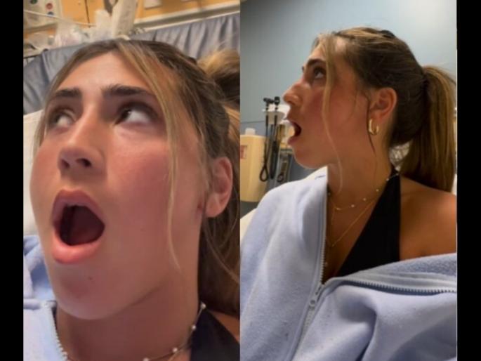 Girl jaw stuck wide open after yawning too fast doctor explains situation | जांभई देताना तरूणीसोबत झालं असं काही, तोंड पुन्हा बंदच झालं नाही; डॉक्टरांनी सांगितलं कारण... Girl jaw stuck wide open after yawning too fast doctor explains situation | जांभई देताना तरूणीसोबत झालं असं काही, तोंड पुन्हा बंदच झालं नाही; डॉक्टरांनी सांगितलं कारण...
