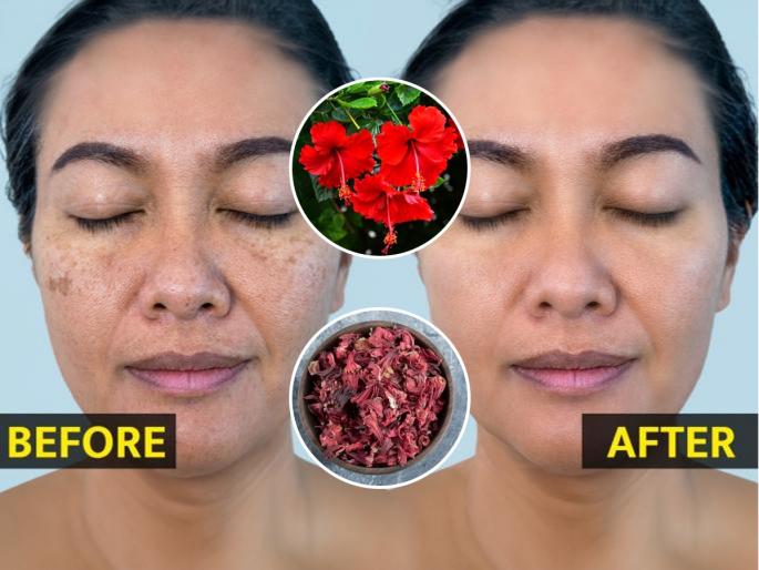 5 Face Packs Made From Hibiscus Flowers Will Reduce Dark Spots & Will Remove The Problem Of Skin 5 Face Packs Made From Hibiscus Flowers Will Reduce Skin Problems | जास्वंदीचे लालबुंद फुल करते त्वचेवर जादू! त्वचेच्या सगळ्या समस्यांवर गुणकारी सुंदर औषध...