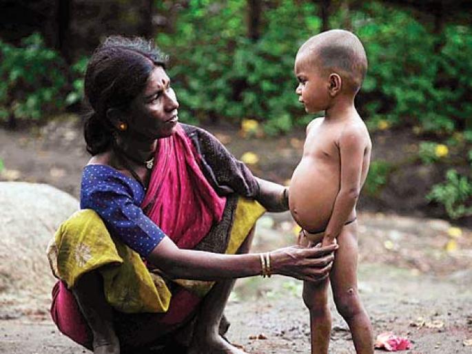 1641 children of Melghat in Amravati district have severely malnourished | अमरावती जिल्ह्यातल्या मेळघाटातील १६४१ बालके तीव्र कुपोषित 1641 children of Melghat in Amravati district have severely malnourished | अमरावती जिल्ह्यातल्या मेळघाटातील १६४१ बालके तीव्र कुपोषित