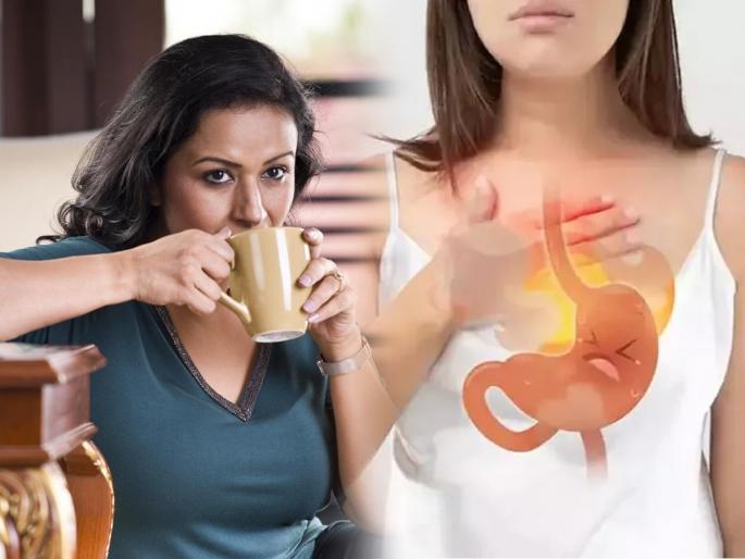 Easy Home Remedy For Acidity Problem : Heartburn, like acidity? Doctor says 3 simple remedies to get rid of acidity... | छातीत जळजळ, सारखी ॲसि़डीटी होते? डॉक्टर सांगतात ३ सोपे उपाय, ॲसिडीटीपासून मिळेल सुटका...