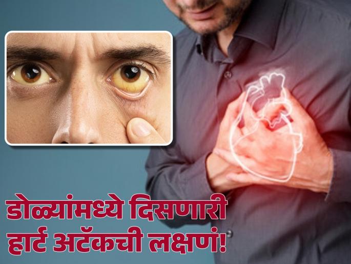 Unusual heart attack symptoms that can appear in your eyes | हार्ट अटॅक येण्याआधी डोळ्यांमध्ये दिसतात ही लक्षणं, वेळीच ओळखून टाळू शकता धोका! Unusual heart attack symptoms that can appear in your eyes | हार्ट अटॅक येण्याआधी डोळ्यांमध्ये दिसतात ही लक्षणं, वेळीच ओळखून टाळू शकता धोका!